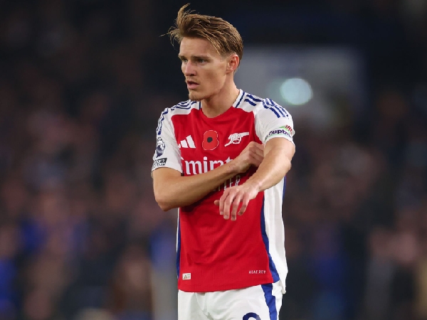 Arsenal dibuat tersiksa dengan absennya Martin Odegaard