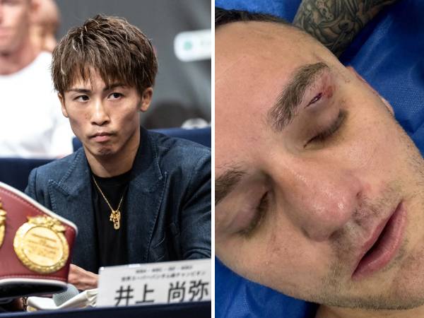 Naoya Inoue (kiri) dan Sam Goodman yang mendapatkan luka di mata kirinya. (Foto: Fox Sports)